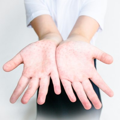 Массажер механический Тех-Пласт 200x180 / И06036