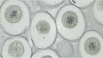Набор микропрепаратов Bresser 74557