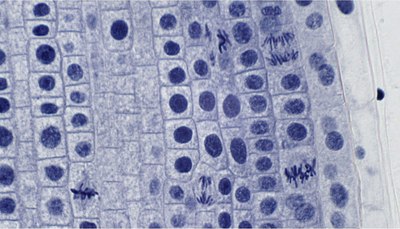 Набор микропрепаратов Bresser 74557